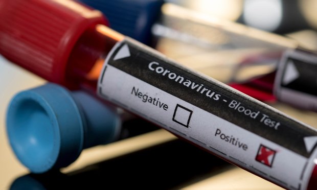 Covid-19  (30 DEC) : 5 décès, 265 guéris et 202 nouvelles contaminations