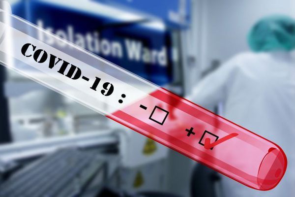 Covid-19  (14 JANV. 2021) : 1 décès, 214 guéris et 99 nouveaux cas positifs