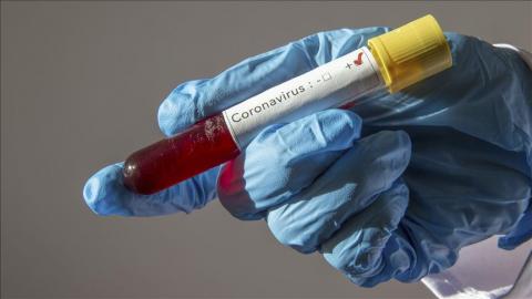 Covid-19 "24 AVRIL 2021" : 0 décès, 33 contaminations et 10 guérisons