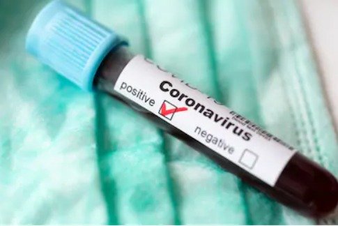 Covid-19  (12 JANV. 2021) : 5 décès, 196 guéris et 96 nouveaux cas positifs