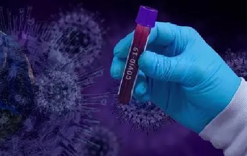 Covid-19 "29 MARS 2021" : 1 décès, 25 cas positifs et 30 cas de guérison