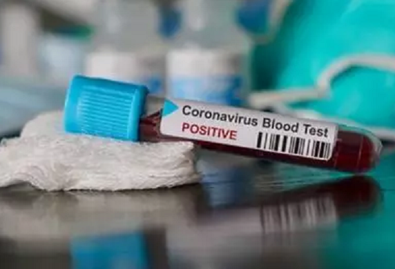 Covid-19 "23 MARS 2021" : 0 décès, 28 cas positifs et 20 cas de guérison