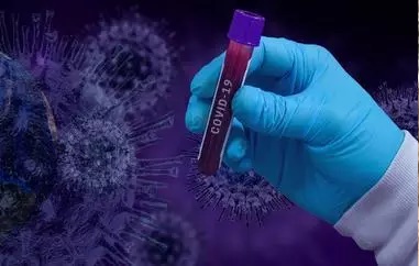 Covid-19 "25 AVRIL 2021" : 0 décès, 17 contaminations et 17 guérisons