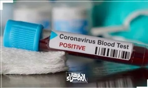 Covid-19 " 5 AOUT 2021" : 2 décès, 329 cas positifs et 180 cas guéris