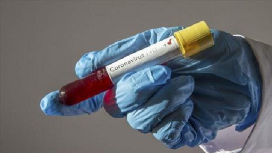 Covid-19 (24 DEC) : 4 décès, 226 guéris et 174 nouvelles contaminations