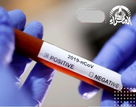 Covid-19 (20 NOV): 41 nouveaux cas positifs, 7 guéris et 1 décès