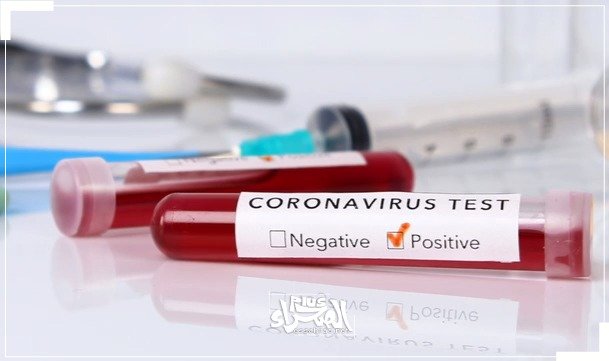 Covid-19 "31 JANV. 2021" : 0 décès, 42 guéris et 27 nouveaux cas positifs