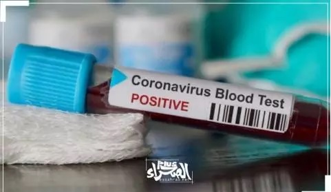 Covid-19 (21 NOV) : 21 nouveaux cas positifs, 12 guéris, 0 décès 