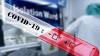 Covid 19 : 27 nouvelles contaminations enregistrées en 24 heures