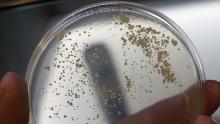 طبق اختبار يحتوي على خلايا ميتة من البكتيريا المسببة لمرض السل (الألمانية)
